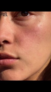 2.2K views · 30 reactions | ချွေးပေါက်တွေကျယ် အဆီတွေအရမ်းပြန်ပြီး...