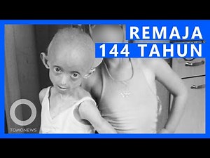 Remaja ‘Benjamin Button’ Meninggal Dalam Tubuh 144 Tahun - TomoNews