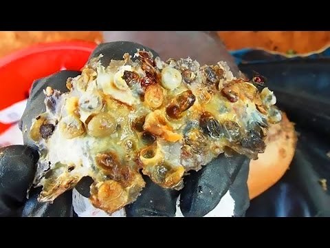 Jiggers Deep in Joseph's Feet! Best Treatment this Month!