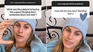 Natalie Roser provides an update on her spinal surgery recovery