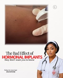 2.3K reactions · 163 shares | The bad effects of hormonal implants...