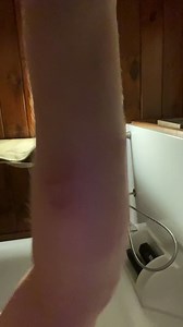 6.4K views · 208 reactions | And critter bite 1,435,567 | Lizzy Long | Facebook