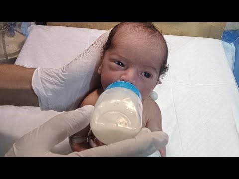 👶 Premature Baby Diagnosis NNJ & Congenital Case | NICU Feeding Protocol & Fluid Management Care