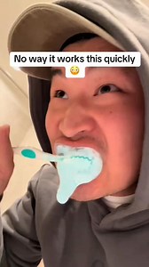 5.5K views · 12 reactions | Everyone’s skeptical about this whitening powder—and honestly, I was too. But after seeing the results, I get it. It’s that good. Not magic… just science that works #magic #dentalcare #oralhygiene #tiktokviral #teethwhitening #brightsmile | SNOW Teeth Whitening | Facebook