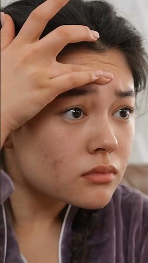 Clear Skin #tazorac #acne #psoriasis #skincare #treatment