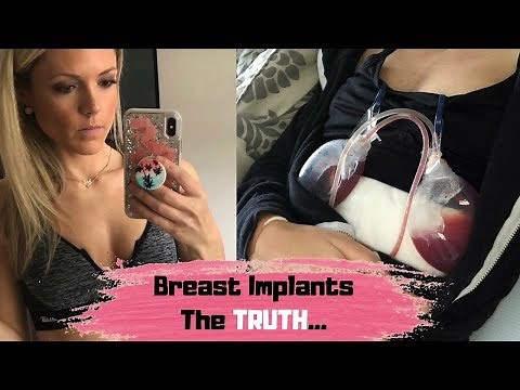 Breast Implants | Before & After Pics | Breast Implant Illness | Q&A