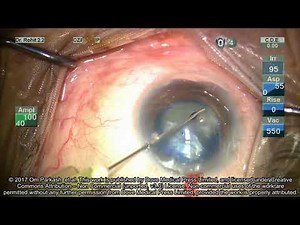 Supplementary Video 3 ID 147510