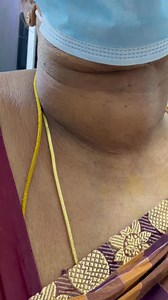 98K views · 2.6K reactions | #தைராய்டு கட்டிகள் #ThyroidCare #thyroidawareness #colloidgoitre #Goiter #GoiterAwareness #ashalenin #homeopathymedicine | Asha Lenin Muthu Raj | Facebook