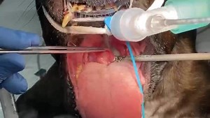 After multiple epiglottopexy failures , we decided to perform partial epiglottectomy with Harmonic Scalpel in a female French Bulldog , 9 years old with epiglottic retroversion . This dog had multiple concurrent respiratory disorders ( Elongated Soft Palate , Laryngeal Polyp , Tracheal Malformation) , and one month ago we removed the laryngeal polyp , we did folded flap , tracheostomy , and epiglottopexy . After 3 weeks , we closed the tracheostomy and the dog started to have inspiratory efort w
