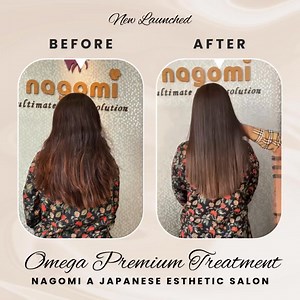 🌙✨ Eid-ul-Adha Special on Omega Premium Treatment! ✨🌙 Give your hair the ultimate luxury care this Eid with our advanced Omega Premium Treatment – for deep nourishment, smoothness & lasting shine! 💆‍♀️💖 🎉 Special Eid Prices: ▫️ Short Hair Offer price – 14,000tk Previously- 20,000tk ▫️ Medium Hair Offer price – 16,100tk Previously- 23,000tk ▫️ Long Hair Offer price– 18,200tk Previously- 26,000tk ▫️ Extra Long Hair Offer price– 21,000tk Previously- 30,000tk 📅 Offer valid till 31st May 2025 �