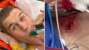 Olympics star shows off gruesome gash in his side after horror cycling crash