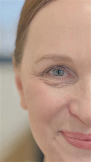 ✨ Instant lifting effect for your face! ✨ With Thread Face Lift, lift sagging areas, tighten your skin, and achieve a more youthful appearance. Enjoy natural and long-lasting results with this minimally invasive treatment. | Özel Mayasante İzmir Polikliniği