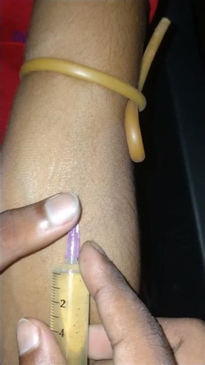 Cannula Insertion Procedure |Step by step IV Cannulation for Nursing& Medical Students#shorts #viral