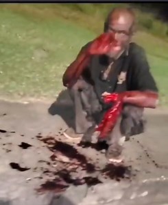 A Man With Hand Chopped Off Left On The Side Of The Road