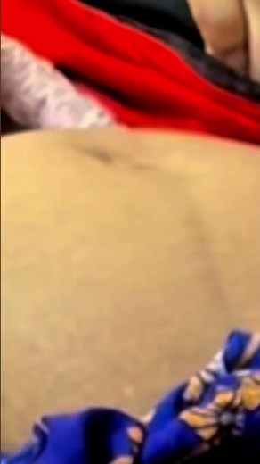 Obstetric Examination steps