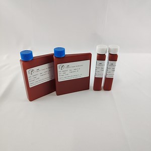 [Hot Item] Lipase (LPS) Test Kits, an Important Tool for The Diagnosis of Pancreatitis
