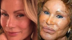 4.9K views · 29 reactions | Crazy Celebrity Plastic Surgeries That Totally Backfired #botched #plasticsurgery | Inform Overload | Facebook