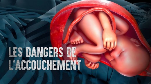 Les 7 complications dangereuses pendant l’accouchement