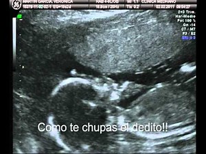 18 semanas de embarazo, niño o niña ???