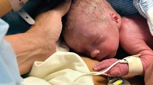 First womb-transplant baby born in Sweden