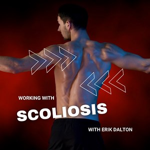 Working with Scoliosis In this video excerpt, Erik Dalton and Paul Kelly work with a client with structural scoliosis. The prognosis for an individual with scoliosis depends on how severe the problem is and how early it is diagnosed and treated. While there is no cure for structural scoliosis, the symptoms can be treated and reduced. Manual therapy is one of the main ways to manage scoliosis symptoms, as well as to maximize functional capacity. There are a number of areas in which you can help t