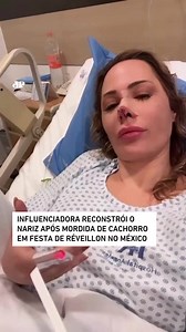 A influenciadora Ju Isen passou por um momento difícil durante uma festa de Réveillon na Cidade do México. Ela foi mordida por um cachorro e perdeu a ponta do nariz, precisando passar por uma cirurgia de reconstrução. Em suas redes sociais, Ju compartilhou um vídeo gravado na cama do hospital, onde contou sobre o ocorrido. Ela já recebeu alta e está se recuperando em casa. 🎥Reprodução: Instagram/ juisen 📺 Confira na JP News e Panflix 👉 https://bit.ly/3T38Vm5 | Jovem Pan Entretenimento