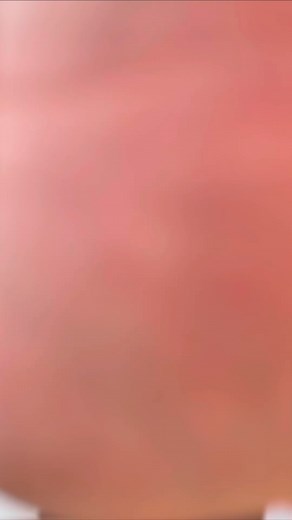 Determining pediatric blood pressures Struggling in paramedic school? We can help with that! 👉 courses.masteryourmedics.com #paramedic #paramedicschool #paramediclife #paramedicstudent #paramedicproblems #paramedico #paramedicsoftictok #nursingstudent #nursingschool #nursing #paramedics | Master Your Medics