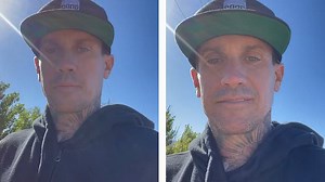 Day 2: Carey Hart gives a post op update after neck surgery