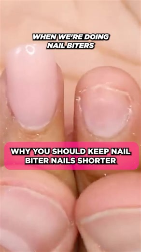19K views · 84 reactions | Are you a nail biter? What length should you get when first starting to get your nails done? YN @karenfornails breaks it down for us. #youngnails #yougnailsinc #nails #naileducation #nailbiz #youngnailsmodernnailartist | Young Nails | Facebook