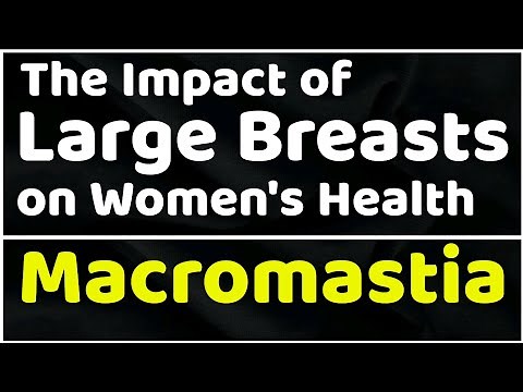 Macromastia: The Impact of Large Breasts on Women's Health