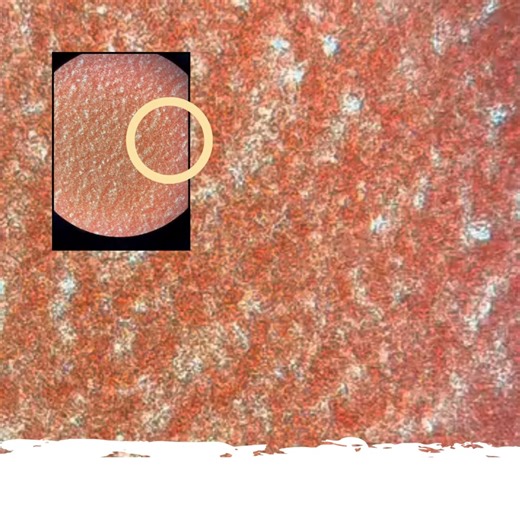 April is Heartworm Awareness Month, and Blue Springs Animal Hospital and Pet Resort wants pet owners to be informed of the risks of heartworm diseases in pets. Heartworm infestation is dangerous and can be costly to treat. Prevention with monthly preventatives is the key to keeping your pet safe from heartworms. Contact us to day if you need to stock up! | Blue Springs Animal Hospital and Pet Resort