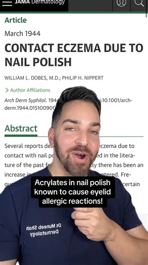 Perioral dermatitis from nail polish 💅 #dermatologist #dermdoctor | Dr. Muneeb Shah