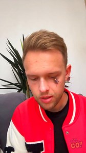 When the Bug Filter Prank Hits Hard 🐛👀 #123go #fun | 123 GO