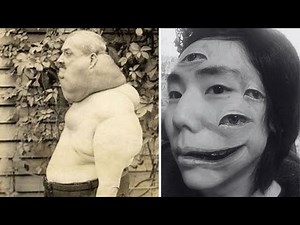 15 Strangest Circus Freaks You Won’t Believe Existed!
