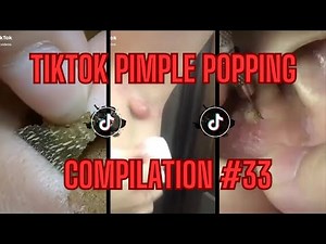 The Biggest Armpit Cyst - TikTok Pimple Popping Compilation EP#33