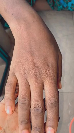 #henna #hennaartist #hennafreckles #blackhenna