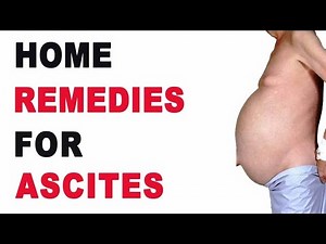 Natural Remedies for Ascites!