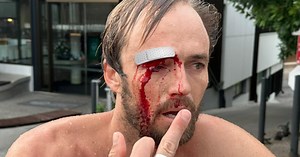 World Champion Surfer Undergoes Brain Surgery After Surfboard Fractures Skull