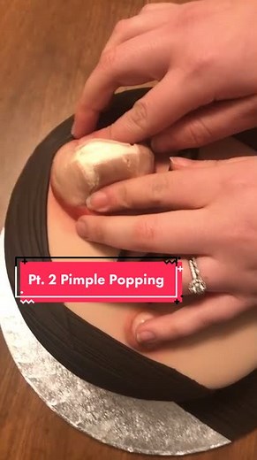 Satisfying Pimple Popping Cake Video