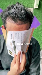 Amazing front hair transplant at Hair Oasis Clinic For details or...