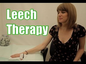 Leech Therapy - Leeches on the Skin of a Woman
