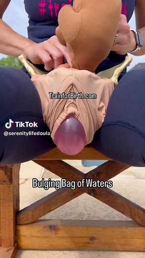 Bulging Bag of Water👉🏼Let it BE!! It will break on its own or baby will be born in the amniotic sac also known as en caul. It’s like a zit or a mysterious button! It has to be popped or touched!! DOES IT REALLY?! Nope! May need a few more #contractions called laboring down before the water breaks. THAT’S OK! The #birthing process doesn’t need to be rushed. Bulging bag of water is common towards the end of the birthing process! It will break when it’s intended to break!!💦 Your baby NEEDS that 