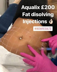 NEW Aqualyx £200 an area  An alternative to liposuction, Aqualyx...