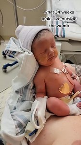 #34weeker #34weekspregnant #preemie #preeclampsia #rainbowbaby #premature #highriskpregnancy | Twin pregnancy