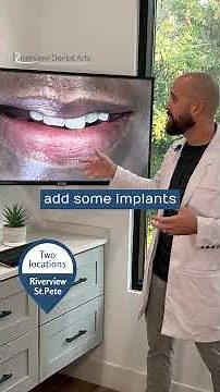 Save Your Teeth: Natural-Looking Smile Makeover with Dental Implants