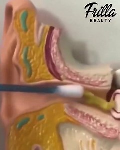 57 reactions · 7 comments | La higiene habitual de los oídos le hace sentir mejor.  - MATERIAL DE ALTA CALIDAD  - DURADERO ✅ - PORTÁTIL Haga clic en https://vigoexpress.es/producto/aspirador-de-cera-para-los-oidos-earsio?psh=3i49&pco=2i99&sp=7712i997 | Vigoexpress | Facebook