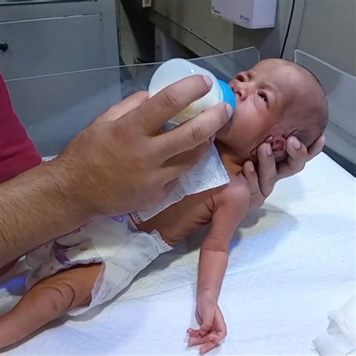 4.8K views · 100 reactions | Neonatal Baby Physiotherapy Care | First Bottle Feed with Love  A neonatal baby receives physiotherapy care along with the lovely milestone of the first bottle feed in the NICU.  These gentle moments show how specialized care and love help tiny fighters grow stronger every day. Truly a heart-touching journey of recovery, hope, and resilience.  #cutebaby #feeding #bottlefeeding | Nurse Life | Facebook