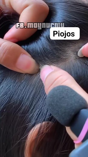 Selalu ada #Asmr #hanoi #vietnam #Brazil #piojos #thailand #spain #liceremoval #kuto | May Nurmy