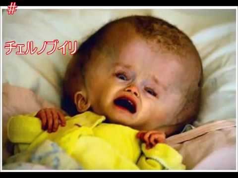 【閲覧注意】世界の奇形児画像がヤバイ！ 写真 画像まとめ