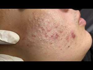 Relax Every Day SacDepSpa #658 (Hoc P3)